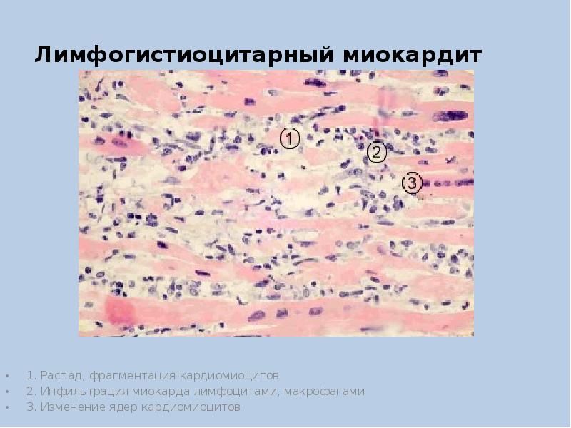 Мастит презентация акушерство