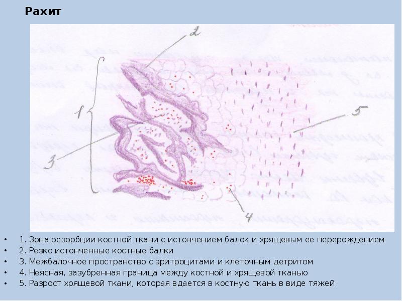 Послеродовый мастит презентация