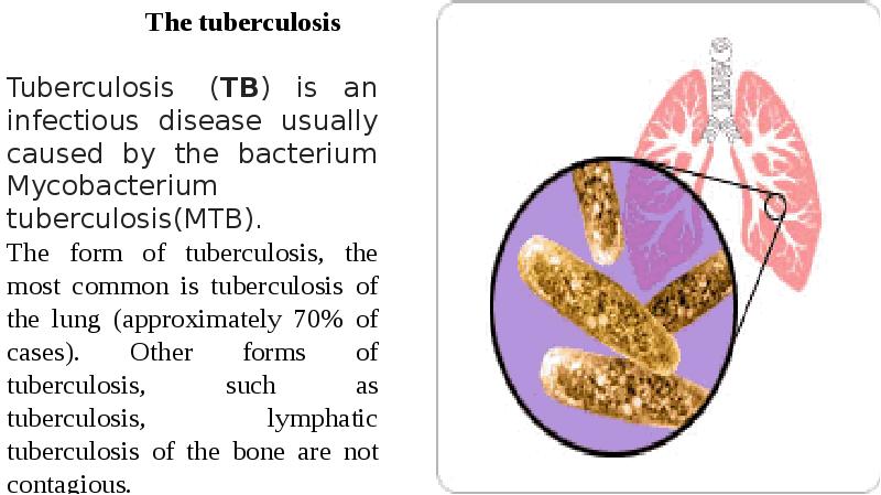 Туберкулез презентация на английском