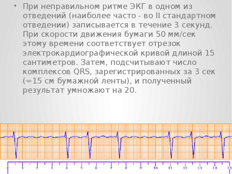 Определить экг по фото онлайн