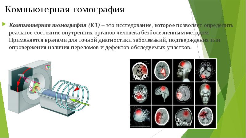 Компьютерная томография презентация