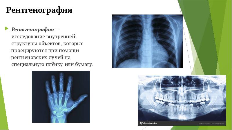 Презентация на тему рентгеноскопия