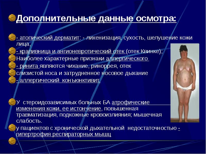Дополнительные данные осмотра: Дополнительные данные осмотра:  - атопический дерматит: -