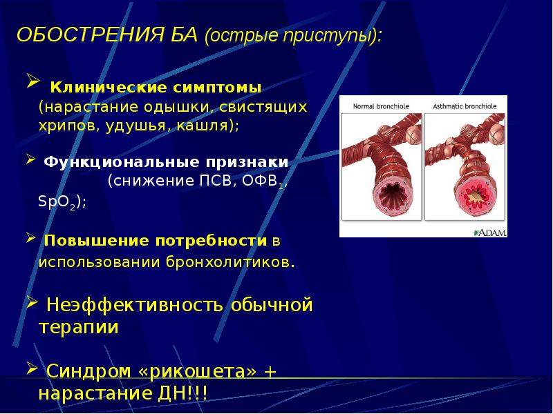 ОБОСТРЕНИЯ БА (острые приступы):