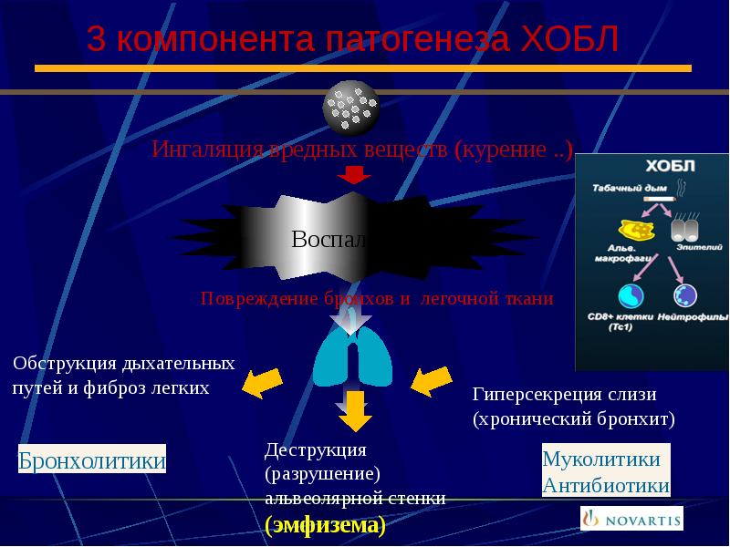 3 компонента патогенеза ХОБЛ
