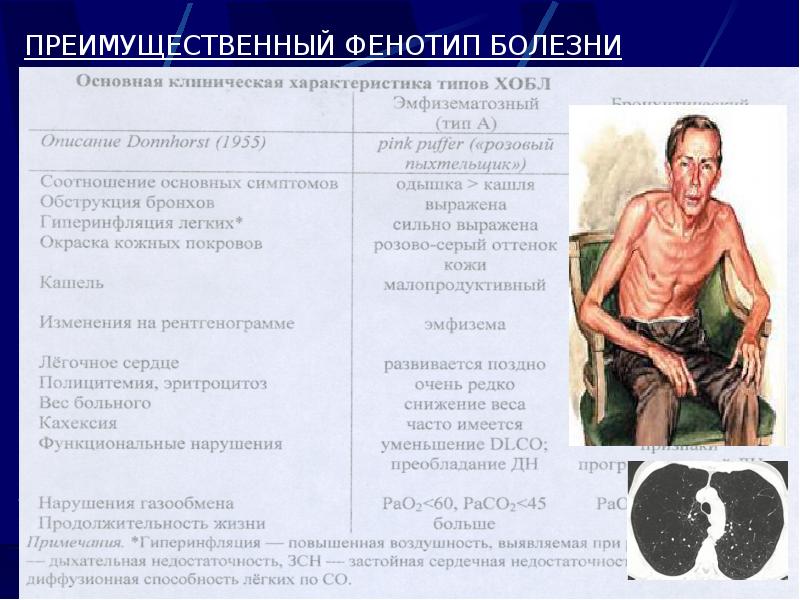 ПРЕИМУЩЕСТВЕННЫЙ ФЕНОТИП БОЛЕЗНИ