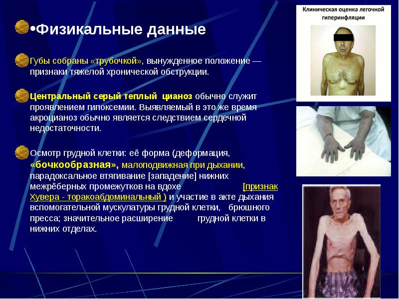 •Физикальные данные •Физикальные данные Губы собраны «трубочкой», вынужденное положение — признаки