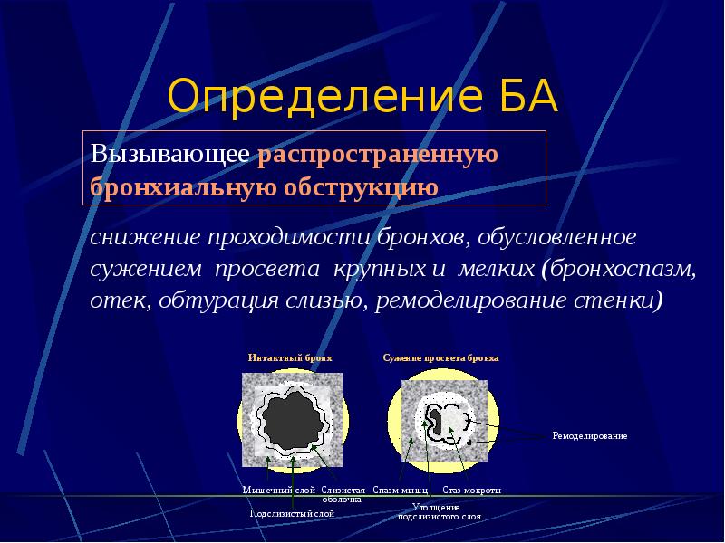 Определение БА