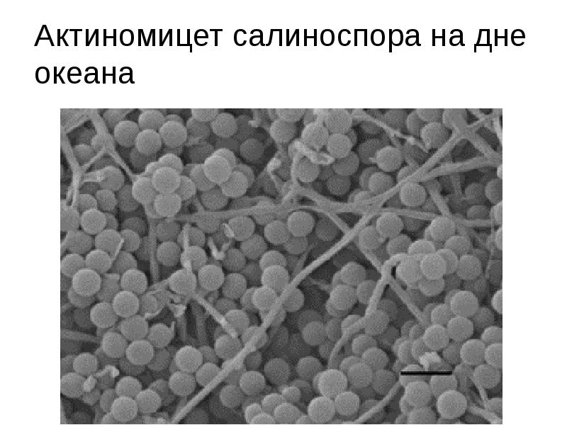 Антибиотиков полученных из актиномицет. Актиномицеты. Особенности актиномицет. Друзы актиномицетов рисунок. Перечислите классификацию актиномицетов по морфологическим группам.