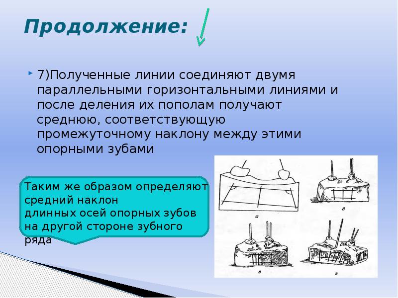 Параллельно и горизонтально. Параллельные линии Соединенные. Ошибки при параллелометрии. Полученная линия соединяет. Метод Новака откуда берутся две параллельные линии.