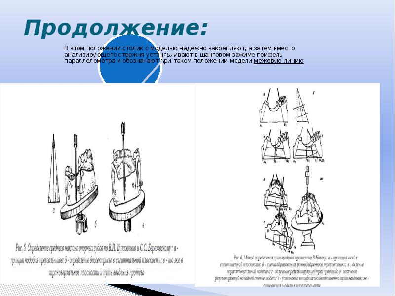 Презентация на тему параллелометрия