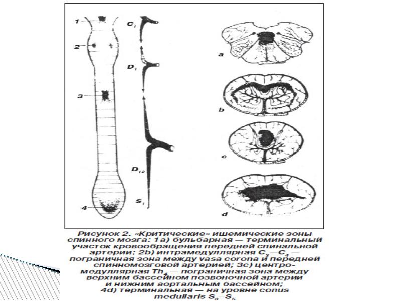 Заболевания спинного мозга. Синдром интрамедуллярного поражения. Сосудистые заболевания спинного мозга. Заболевания спинного мозга презентация. Пограничная зона спинного мозга.