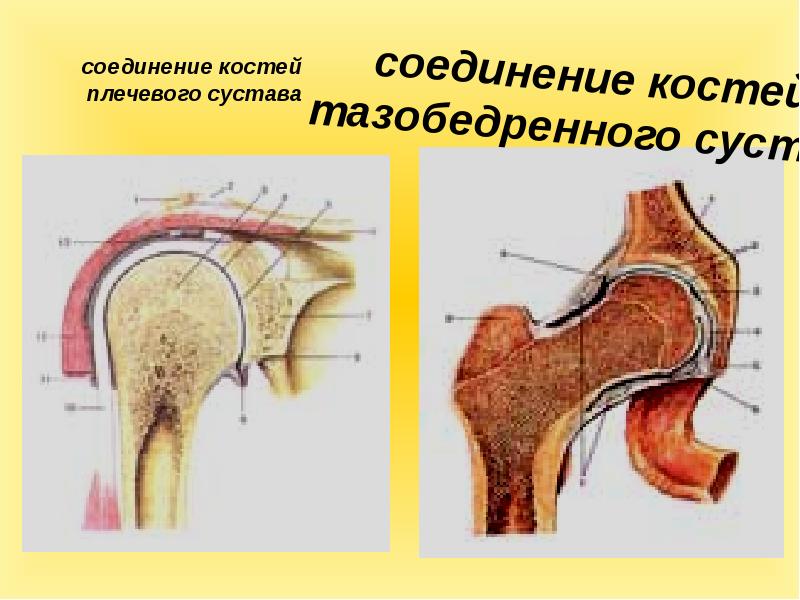 Презентация первая помощь при травмах растяжении связок вывихах суставов переломах костей 8 класс