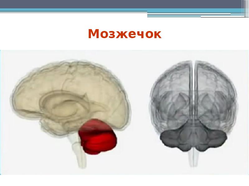 Нарушения моста мозга. Нарушения моста мозга