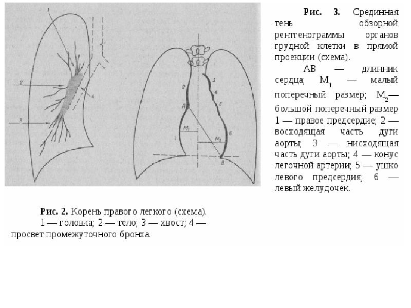 Легочный рисунок при пробе мюллера