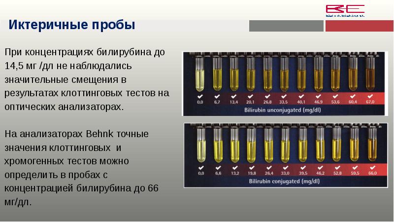 иктеричная сыворотка. иктеричность плазмы. иктеричная сыворотка. иктеричная сыворотка. гемолиз хилез иктеричность.