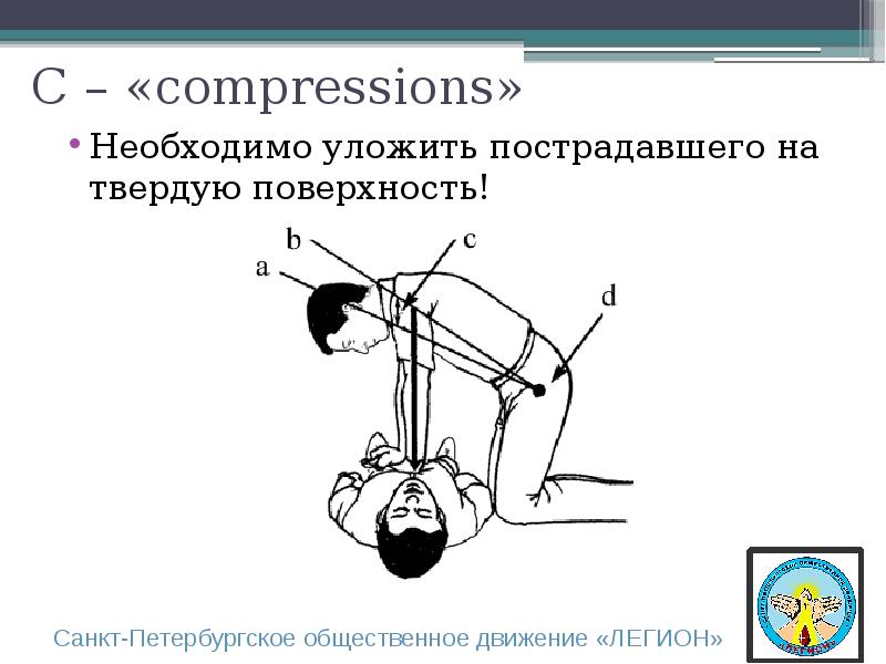 Осложнения сердечно легочной реанимации. Уложить пострадавшего на твердую поверхность. Compressions..