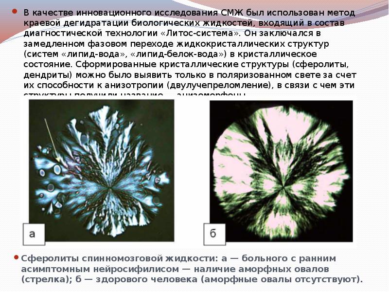 В качестве инновационного исследования СМЖ был использован метод краевой дегидратации биологических В качестве инновационного исследования СМЖ был использован метод краевой дегидратации биологических