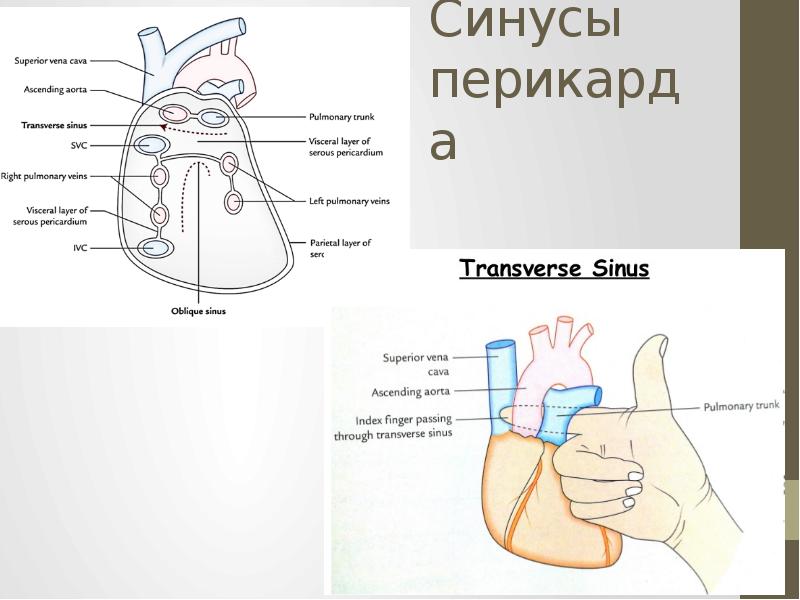 Пазухи перикарда картинки