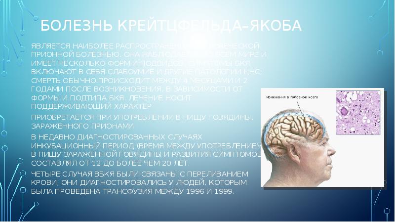 Болезнь Крейтцфельда–Якоба
является наиболее распространенной человеческой прионной болезнью. Она наблюдается во Болезнь Крейтцфельда–Якоба
является наиболее распространенной человеческой прионной болезнью. Она наблюдается во