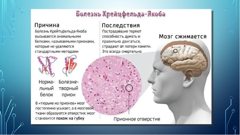 Прионы новые возбудители болезней проект