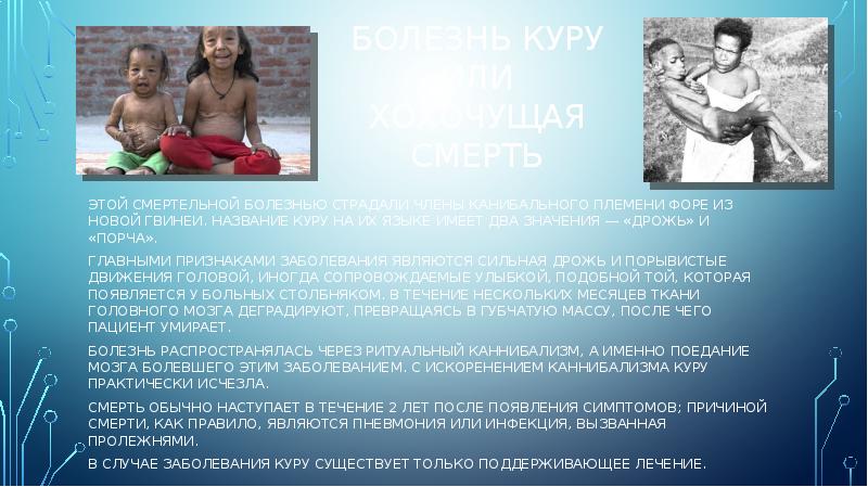 Болезнь куру или хохочущая смерть
Этой смертельной болезнью страдали члены канибального Болезнь куру или хохочущая смерть
Этой смертельной болезнью страдали члены канибального