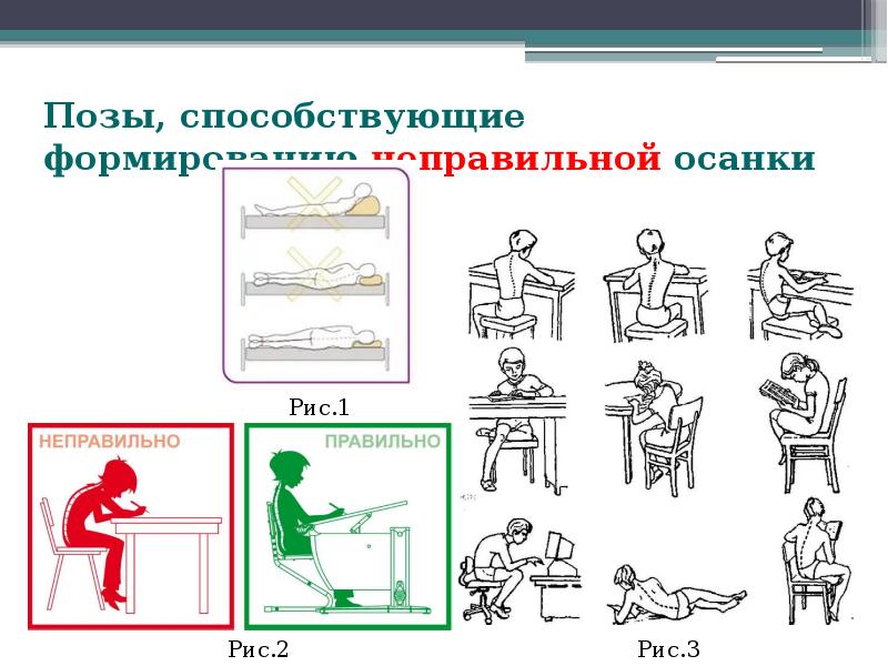 Виды нарушения осанки профилактика нарушений