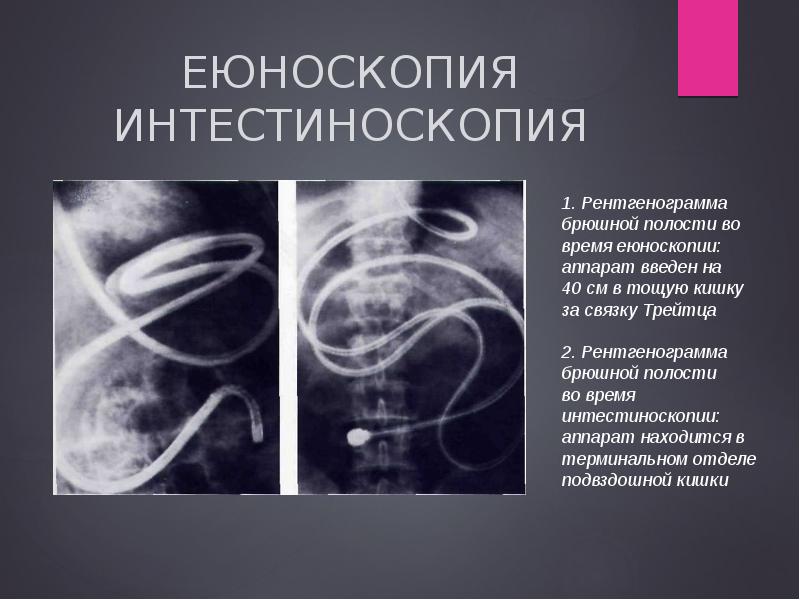 Эндоскопические методы исследования презентация