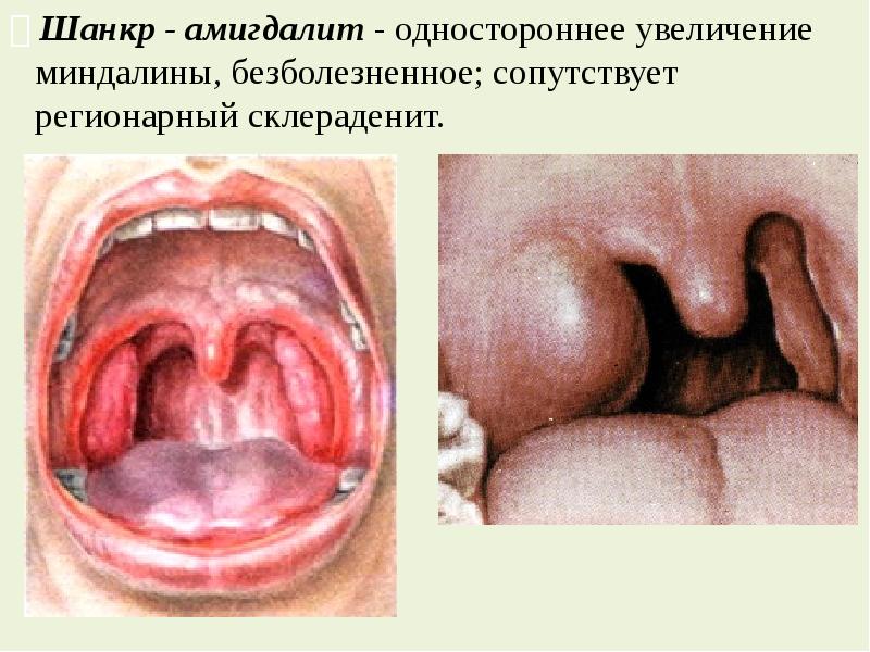 Ограничение доступа