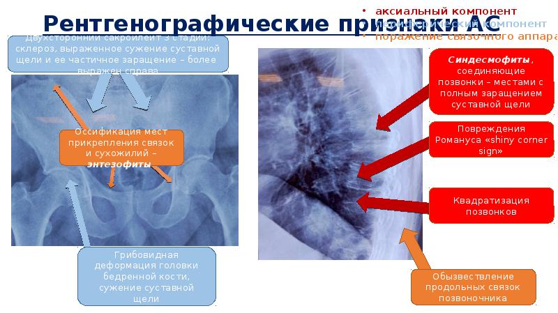 Ас признаки