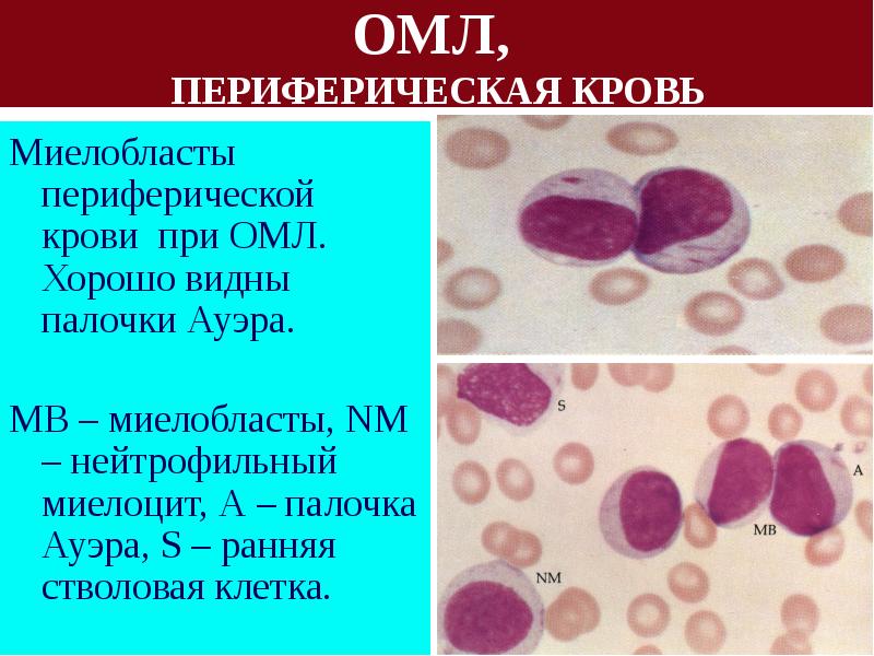 Патофизиология системы крови презентация