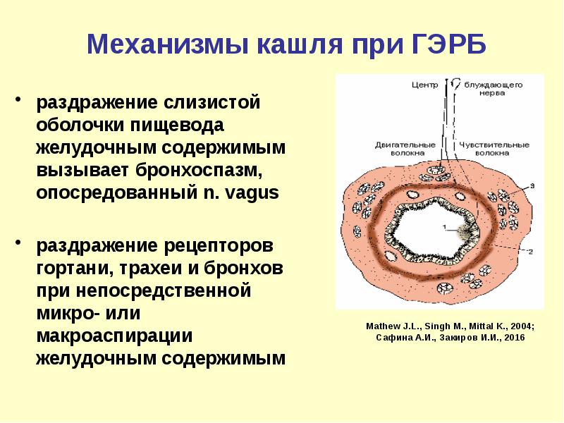 12 семиотика кашля у детей