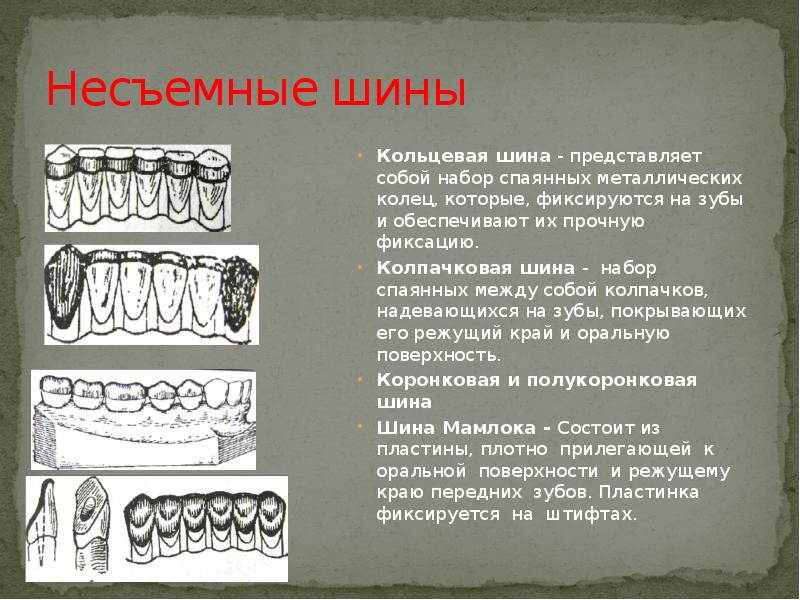 Виды шинирования в ортопедической стоматологии презентация