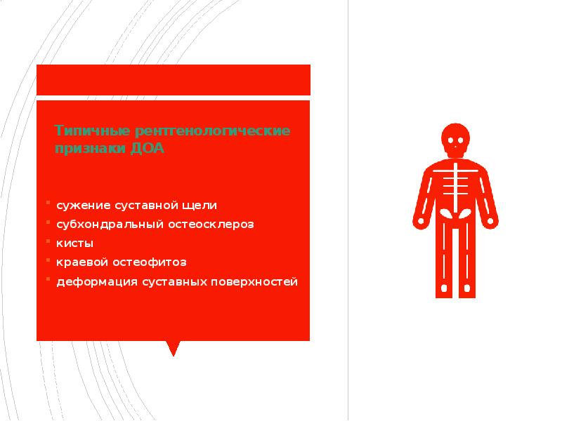 Типичные рентгенологические признаки ДОА сужение суставной щели субхондральный остеосклероз кисты краевой