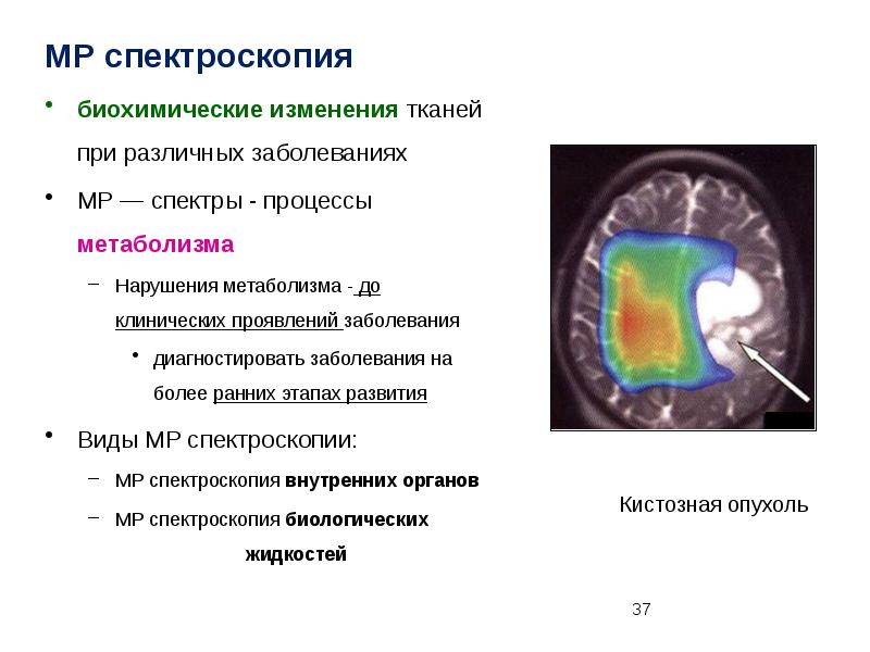 Изменения в тканях. Нейровизуальные методы исследования.