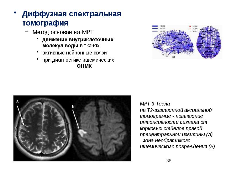 Диффузионно взвешенное изображение