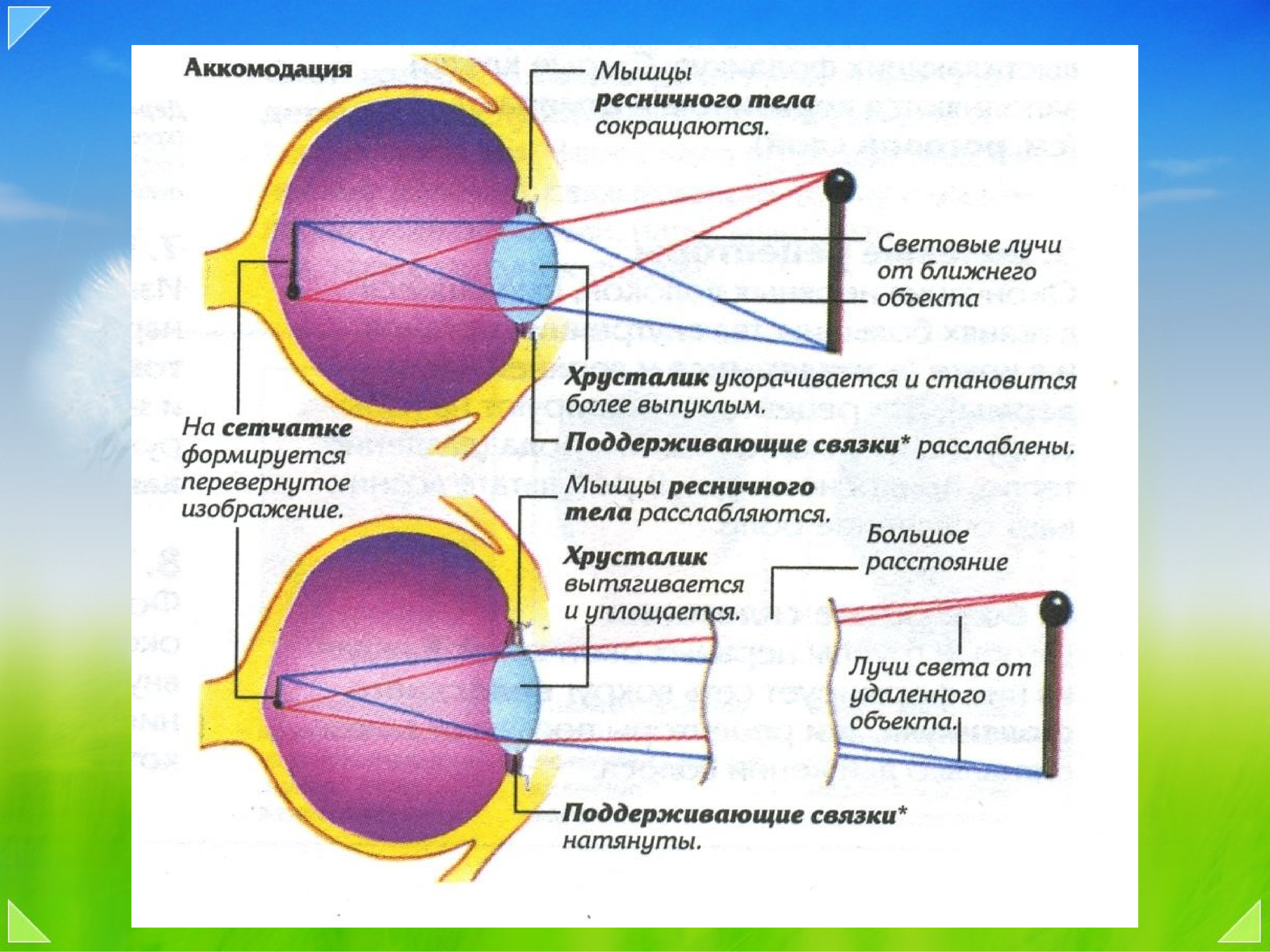 Заболевания аккомодации. Рефракция и аккомодация глаза. Механизмы аккомодации и рефракции рисунок. Спазм аккомодации схема. Аккомодация хрусталика глаза.