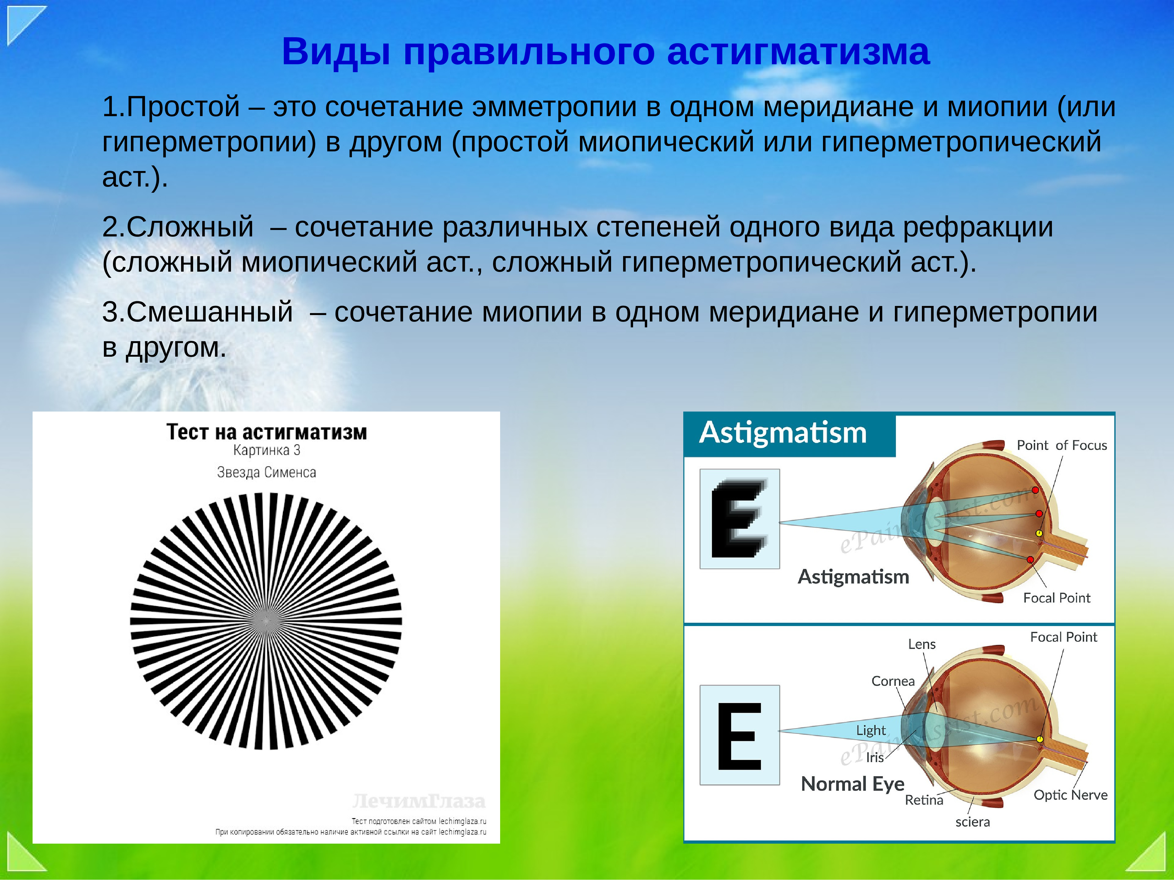 Сложный гиперметропический астигматизм глаз. Сложный гиперметропический астигматизм. Астигматизм - 2.25. Типы правильного астигматизма. Сложный смешанный астигматизм.