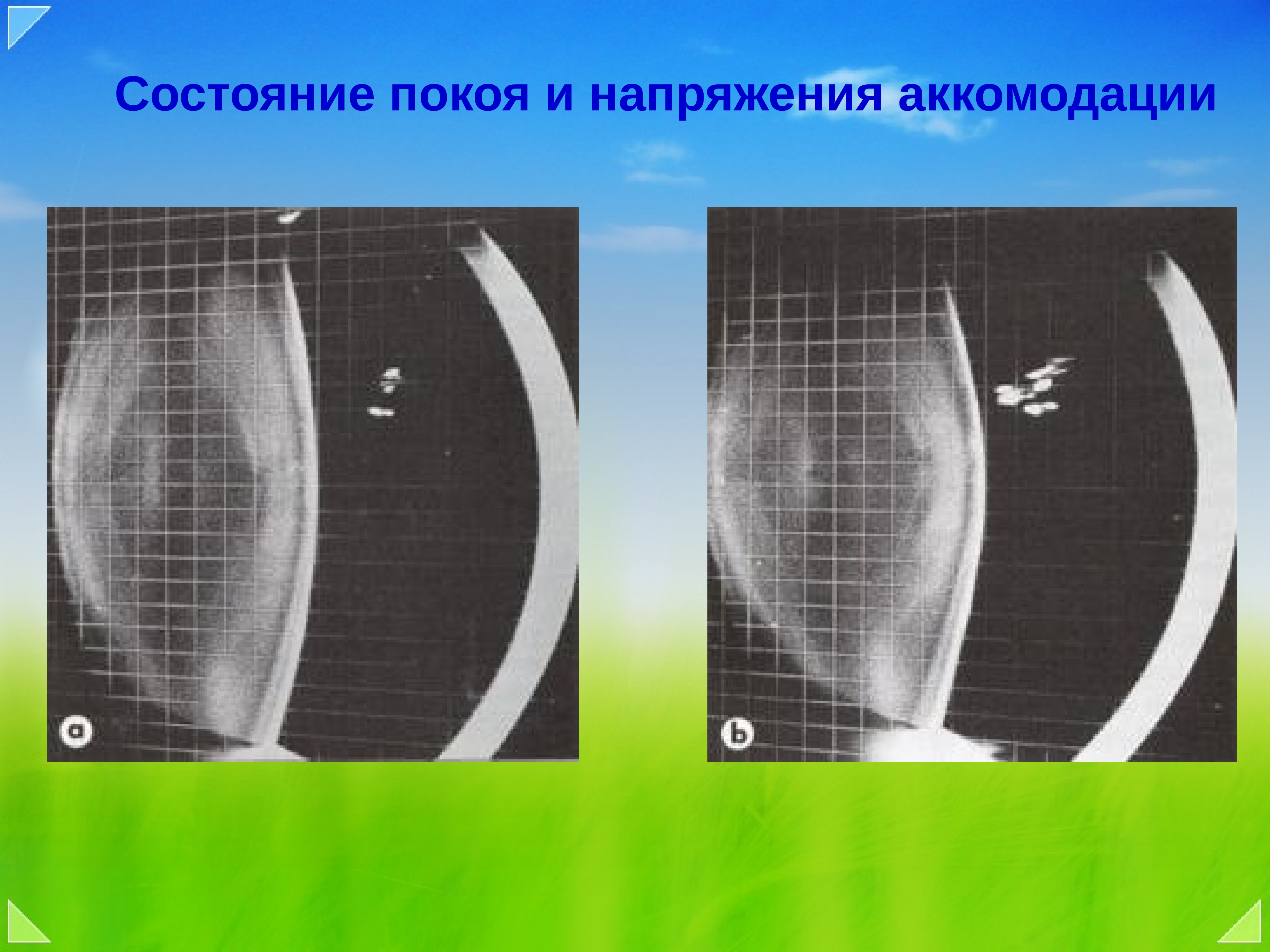 H 52.5 нарушения аккомодации