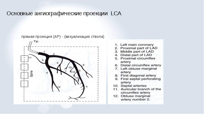 Рентгенэндоваскулярная диагностика презентация