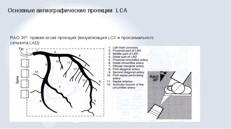 Рентгенэндоваскулярная диагностика презентация