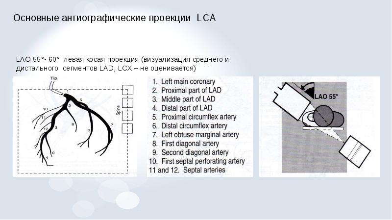 Рентгенэндоваскулярная диагностика презентация