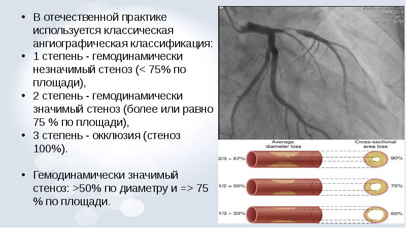 Рентгенэндоваскулярная диагностика презентация