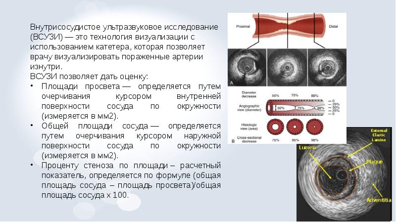 Рентгенэндоваскулярная диагностика презентация