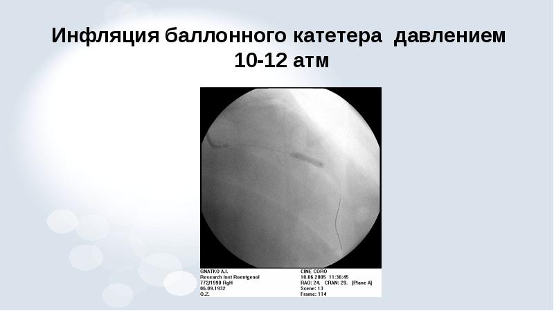 Рентгенэндоваскулярная диагностика презентация