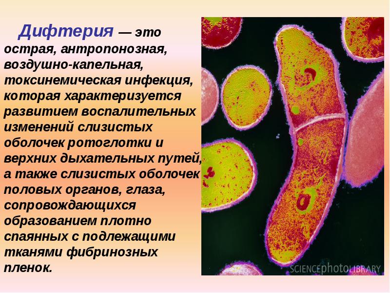 Возбудитель дифтерии является. Дифтерия это антропонозная инфекция. Дифтерия возбудитель заболевания. Возбудители дифтерии являются.