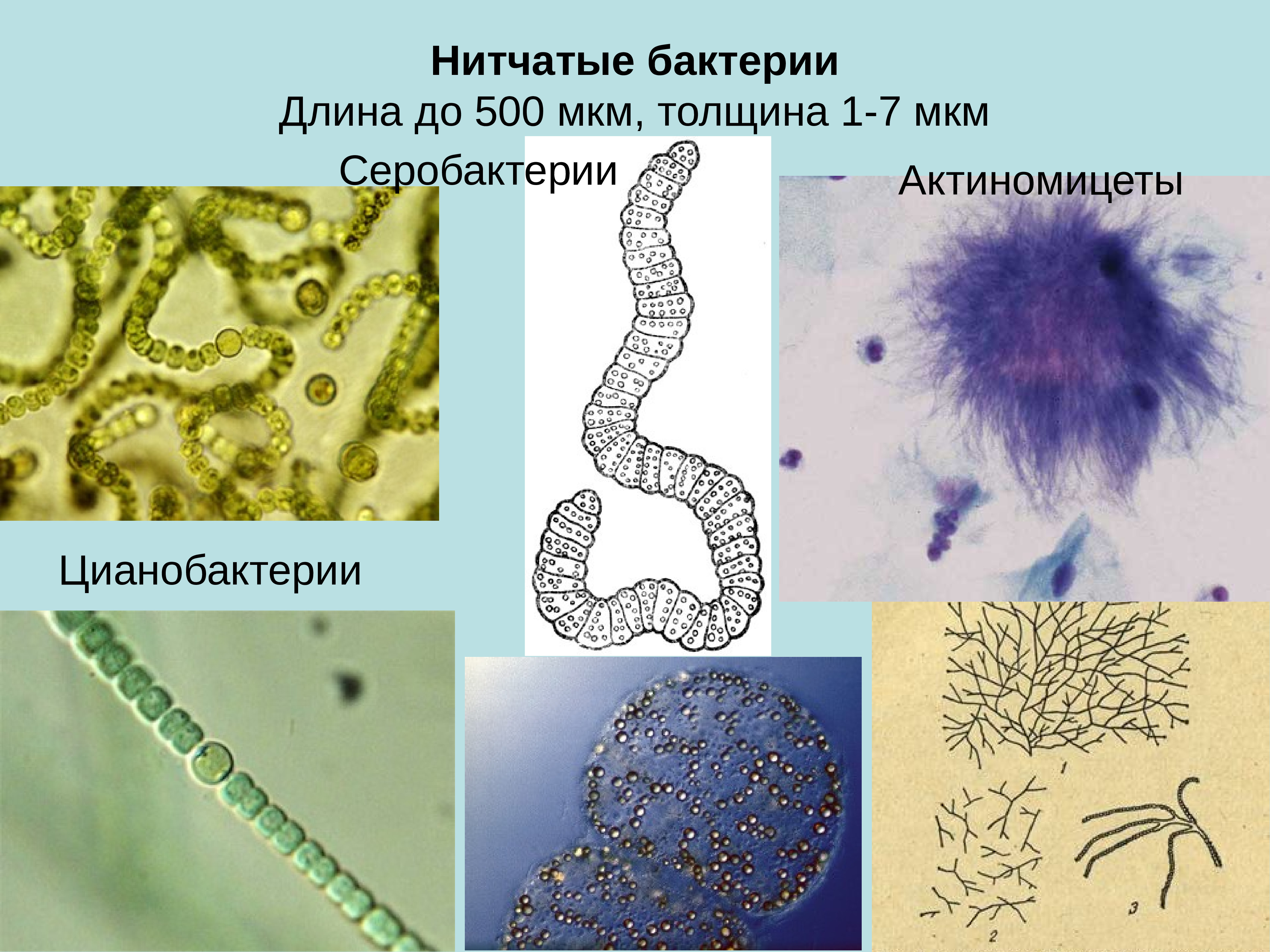 Нитевидные бактерии. Цианобактерии железобактерии серобактерии. Цианобактерии бациллы. Нитчатые формы бактерий актиномицеты. Нитчатые бактерии.