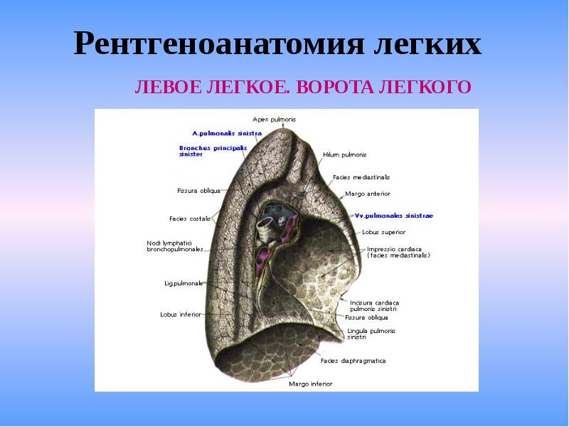 Лучевая диагностика органов дыхания презентация