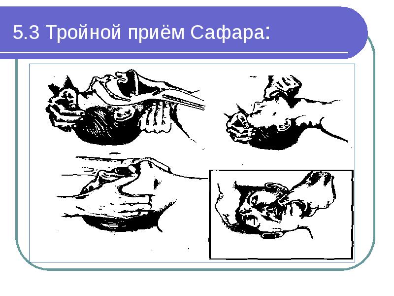 Прием сафара картинки