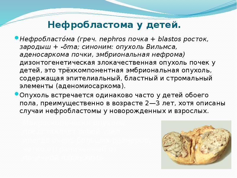 Нефробластома. Классификация нефробластомы у детей. Причины нефробластомы.